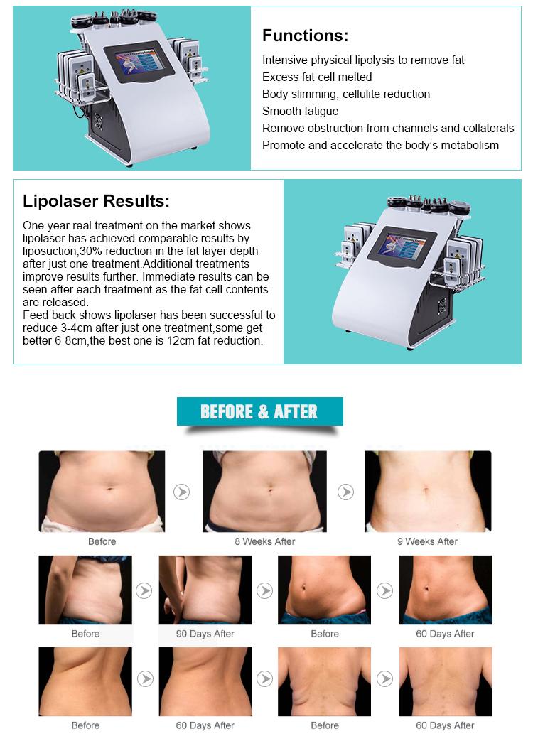 6in1 Cavitation Ultrasonic RF Beauty Cellulite Removal Fat Reduction Lipo Laser Slim Machine - CSTrueBeauty