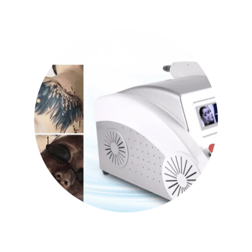 Tattoo Removal - CSTrueBeauty