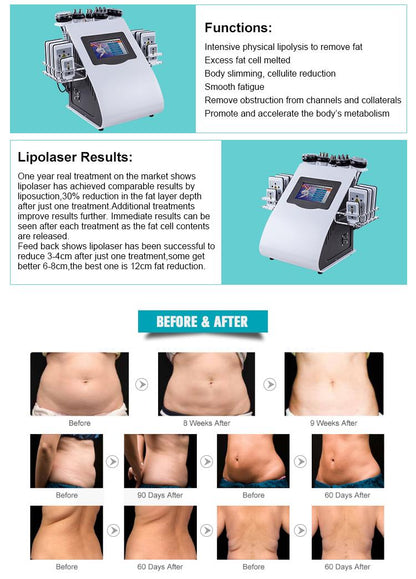 6in1 Cavitation Ultrasonic RF Beauty Cellulite Removal Fat Reduction Lipo Laser Slim Machine - CSTrueBeauty