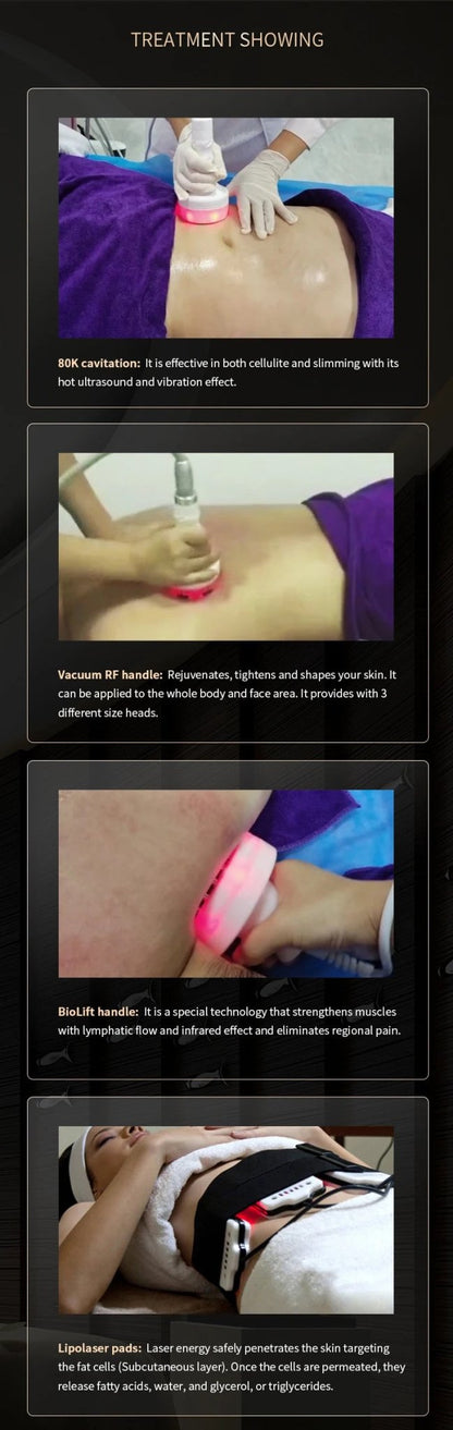 80K cavitation slimming machine - CSTrueBeauty