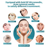 Top Seller Radio Frequency Rf Microneedling Machine Microneedle Rf Machine