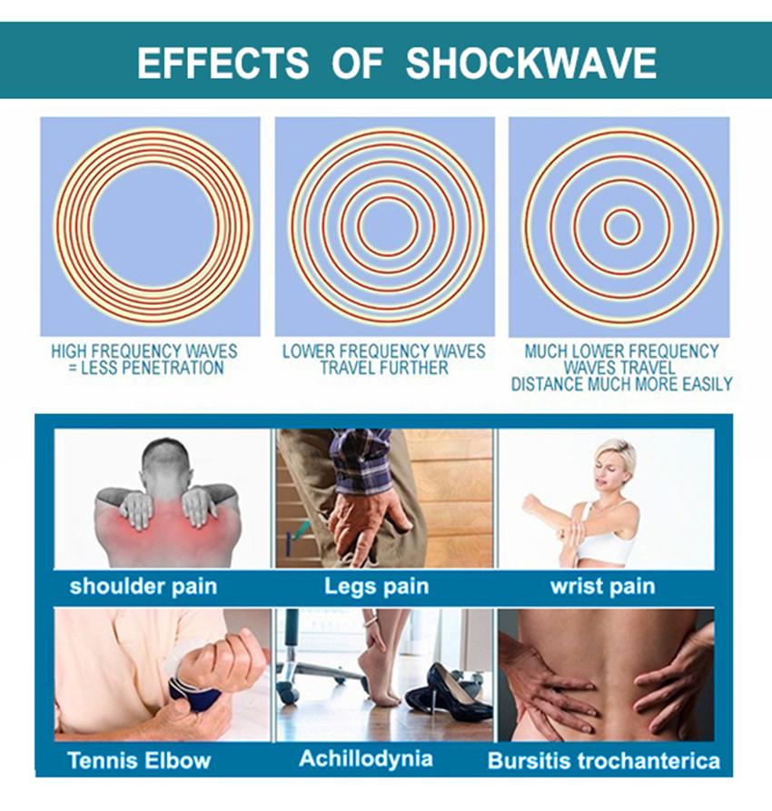 High quality Low intensity ED shock wave therapy machine/acoustic wave therapy shockwave therapy machine for treat pain/ED treatment machine - CSTrueBeauty